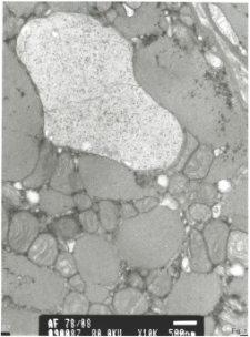 Studies of heart ultrastructure in various diseases by prof A. Fidziańska-Dolot: heart muscle toxic damage - 78/08