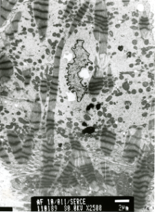 Studies of heart ultrastructure in various diseases by prof A. Fidziańska-Dolot: heart failure - 10/11