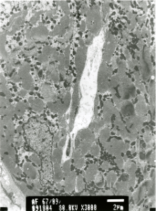 Studies of heart ultrastructure in various diseases by prof A. Fidziańska-Dolot: heart failure - 67/09