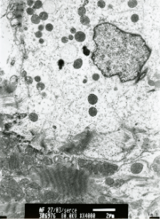 Studies of heart ultrastructure in various diseass by prof A. Fidziańska-Dolot (2004-2013) - 27/03