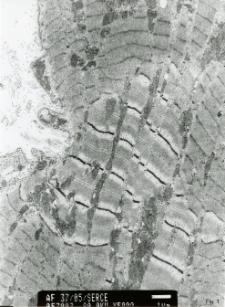 Studies of heart ultrastructure in various diseass by prof A. Fidziańska-Dolot (2004-2013) - 37/05